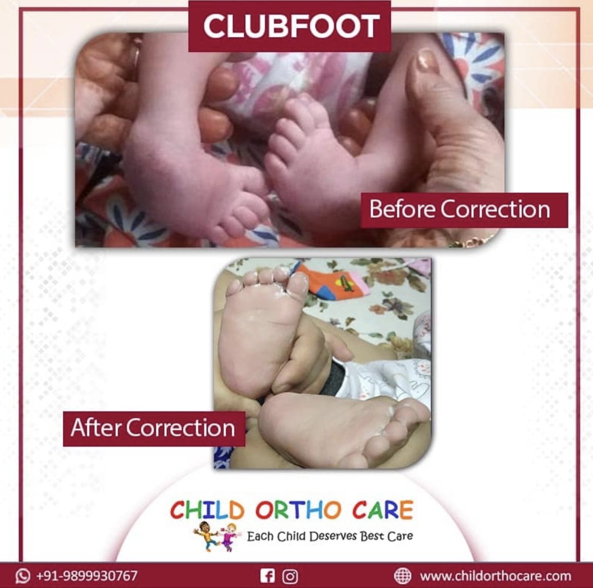 CTEV Treatment in Uttar Pradesh